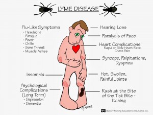 blog Lyme Disease symptoms